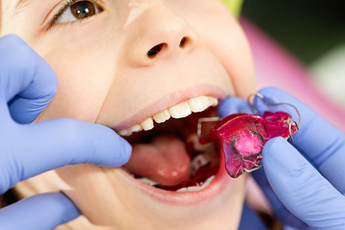 Orthodontic Treatment for Children in Surrey