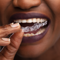 Invisalign Smile Assessment, Orthodontics, Surrey