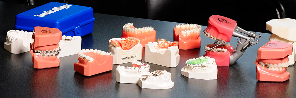 Orthodontic & Braces Options, Surrey