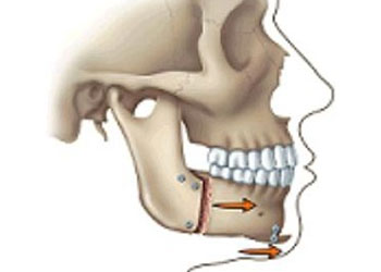 FAQS, Orthodontics & Braces, Surrey